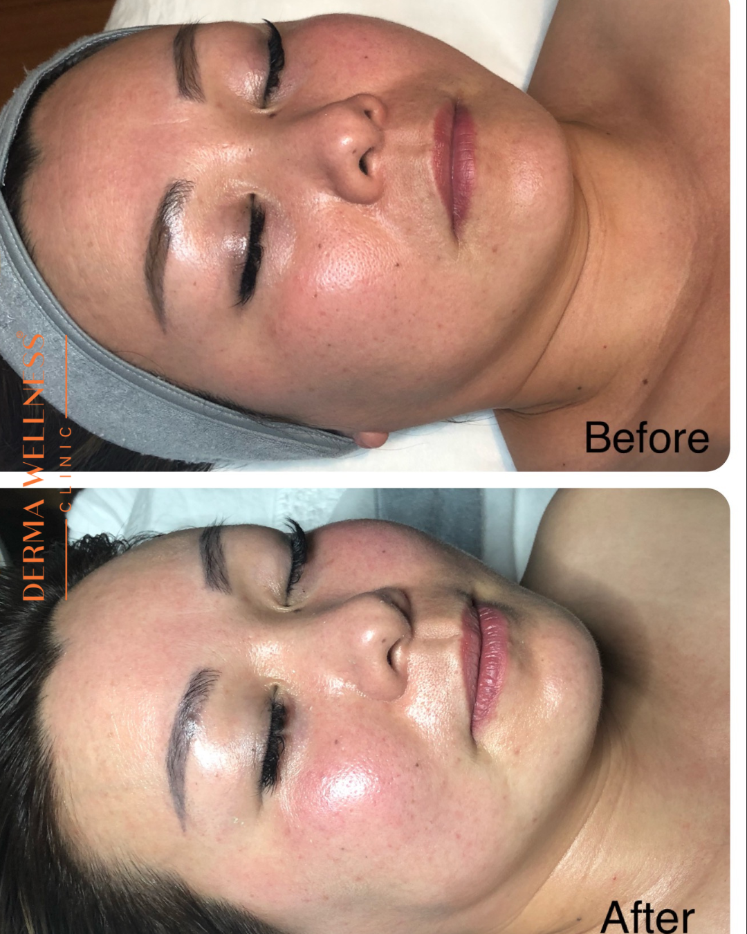 New Client | Consultation + Buccal Massage Facial + LED