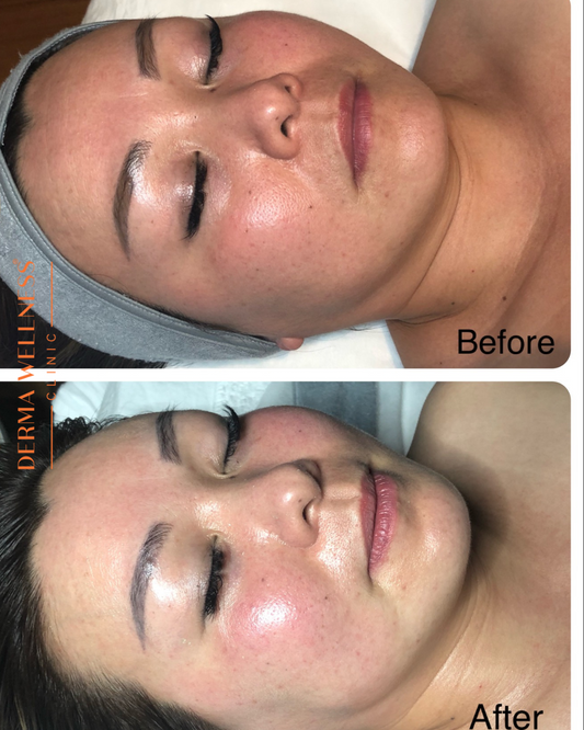 New Client | Consultation + Buccal Massage Facial + LED