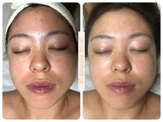 New Client | Consultation + Bespoke Facial + LED